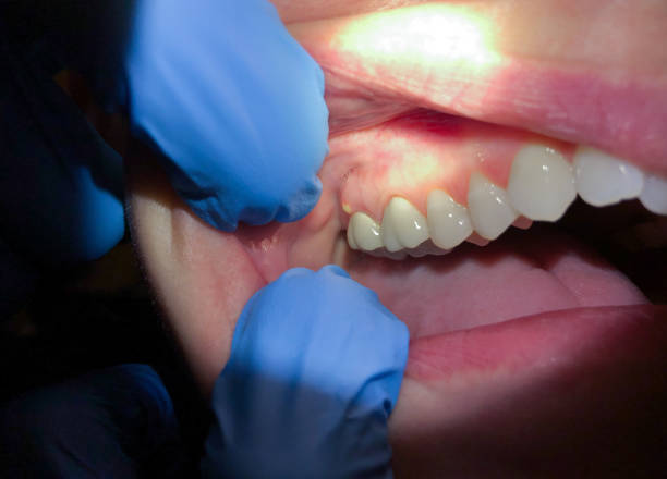 Best Pediatric Emergency Dentist in Ocilla, GA