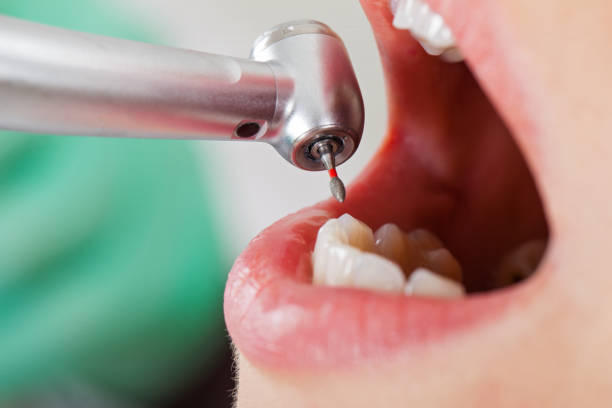Best Emergency Cosmetic Dentistry in Ocilla, GA